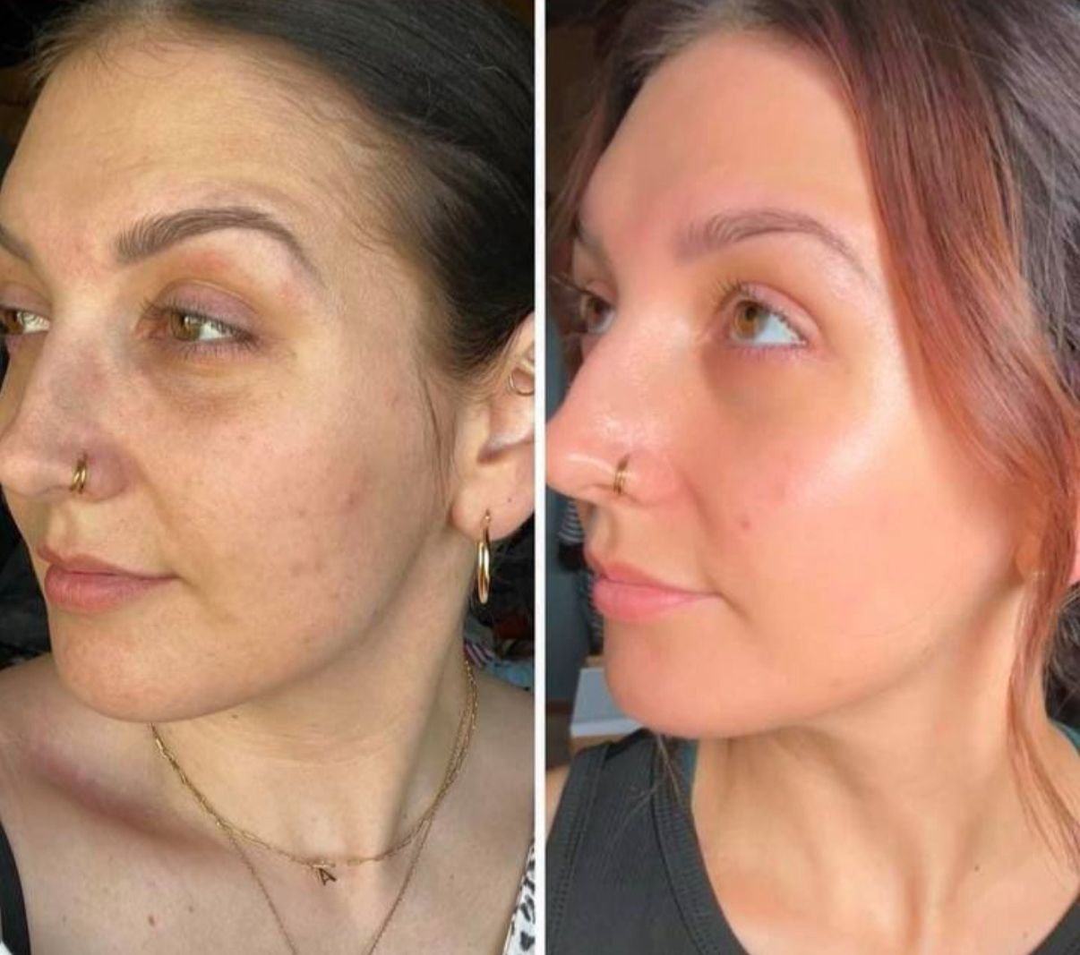 Before and after RIMAN — texture and tone