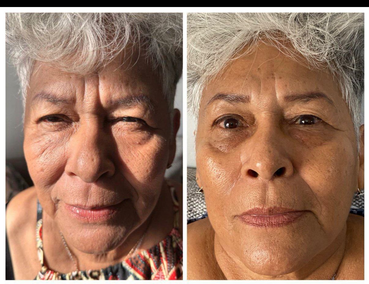 Before and after RIMAN — wrinkles and texture